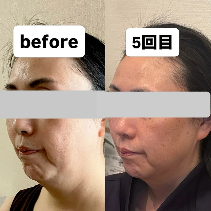 画像385