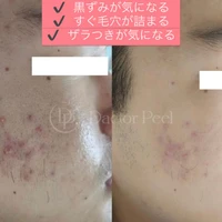 画像403