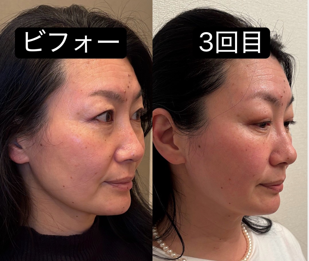 4. 実際のお客様の声