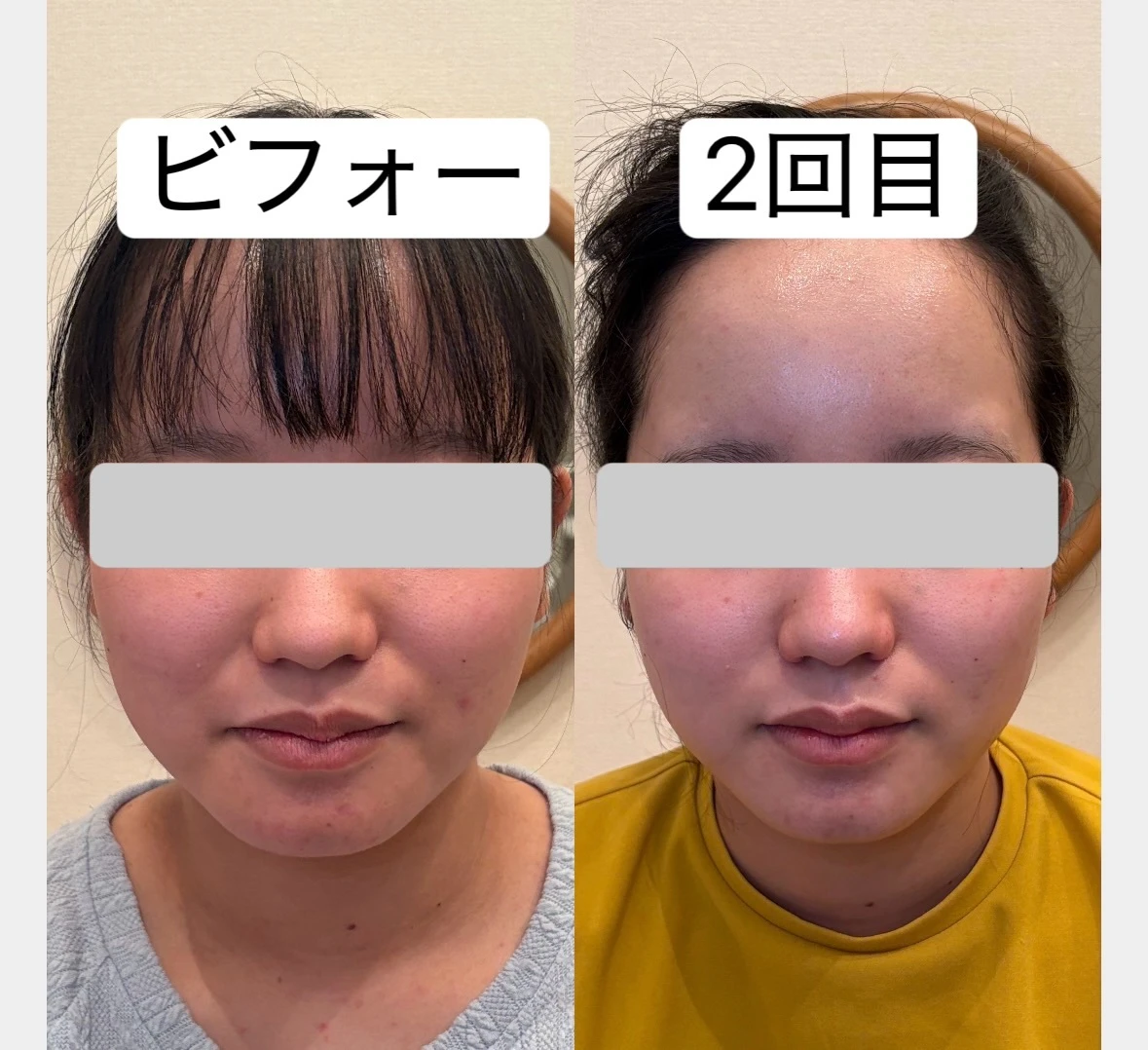 ダウンロード