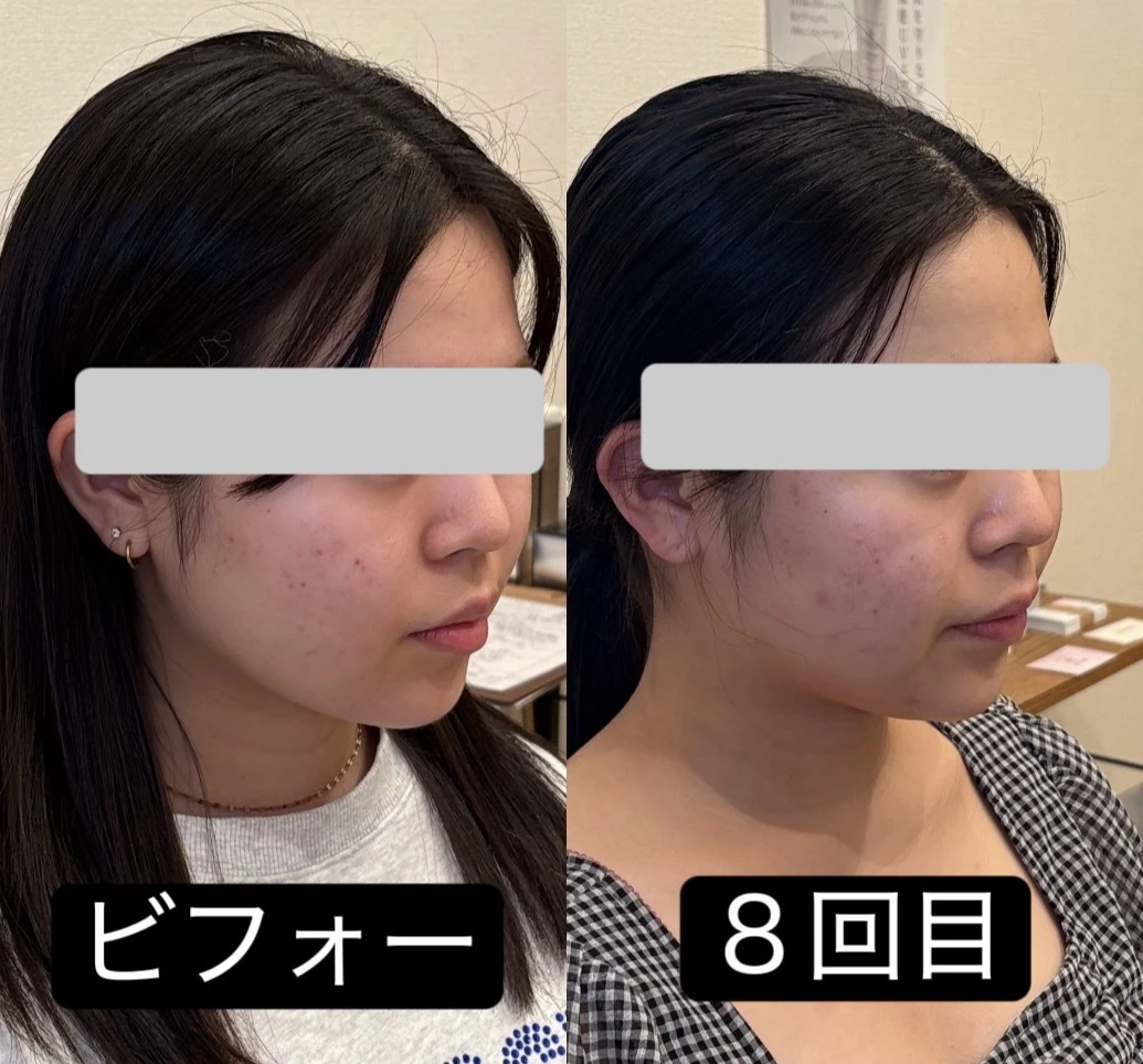 ダウンロード