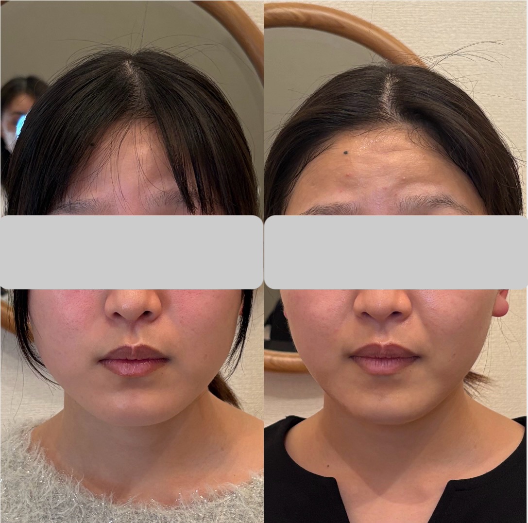 aaaaa