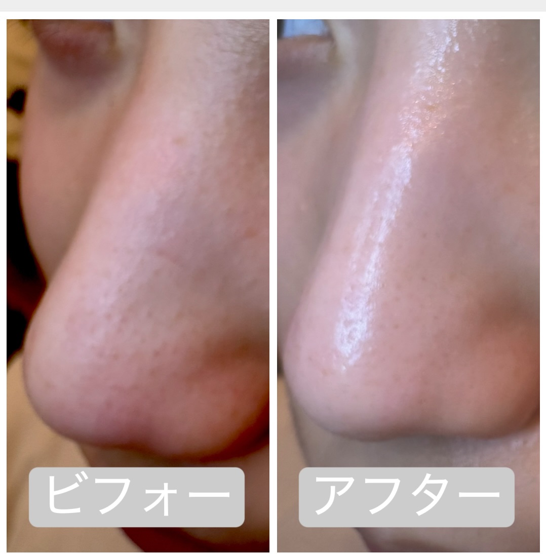 今すぐお問い合わせを！