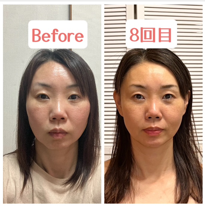 リフトアップ効果を体験しよう！